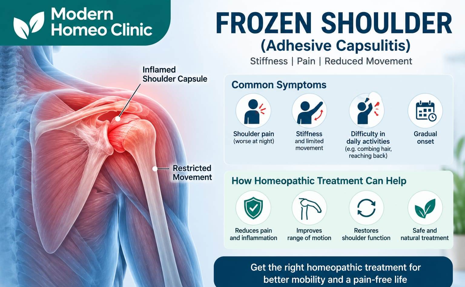 Frozen shoulder (adhesive capsulitis) — symptoms and treatment